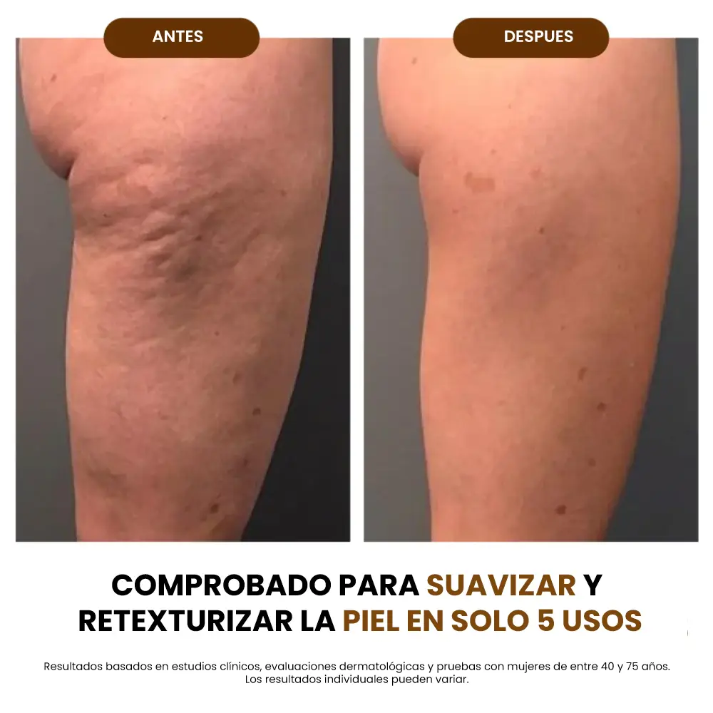 Silk Body - 2X1 - Piel más firme, suave y radiante.